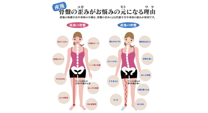 産後の骨盤矯正の解説画像