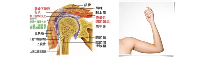 五十肩（肩関節周囲炎）の解説画像